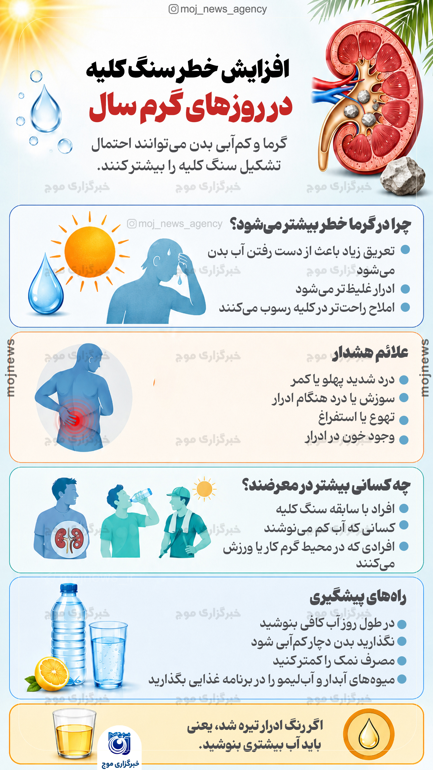 افزایش خطر سنگ کلیه در روزهای گرم سال copy