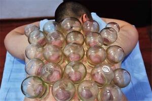 بادکش؛ جدیدترین درمان ورزشکاران المپیکی + تصاویر