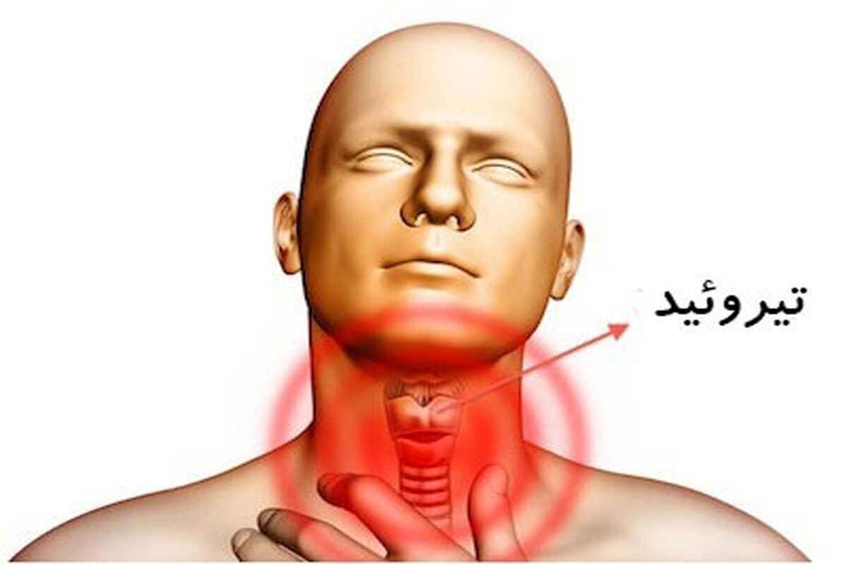 هورمون تیروئید
