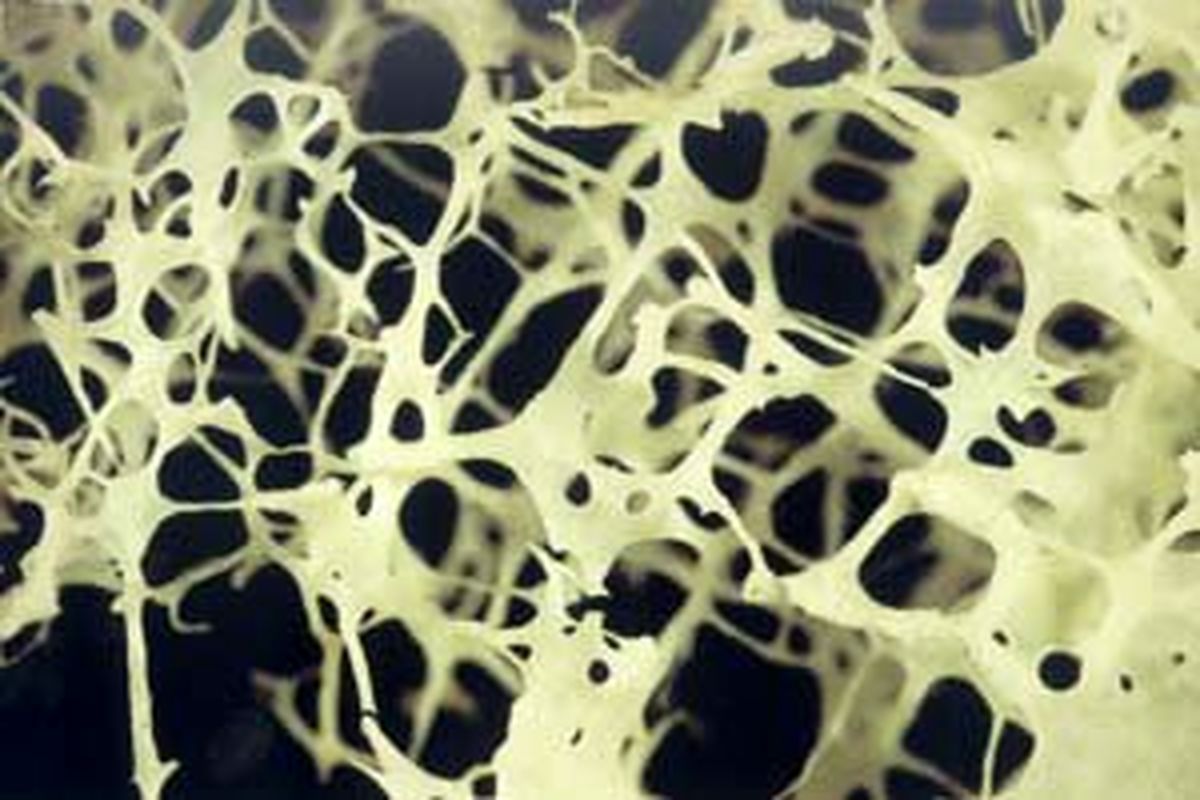 بافت استخوان