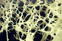 ورزش چربی استخوان را از بین می‌برد