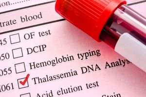 اعلام آمادگی دانشگاه علوم پزشکی گیلان برای راه اندازی اولین مرکز جامع خدمات بیماران تالاسمی