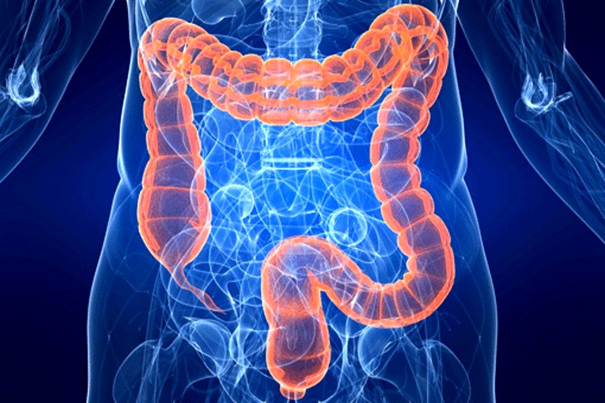 روده بزرگ 