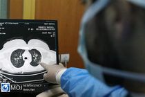 جدیدترین آمار کرونا در کشور تا ظهر ۱۶ شهریور ۹۹/ شناسایی یک هزار و ۹۹۲ بیمار جدید