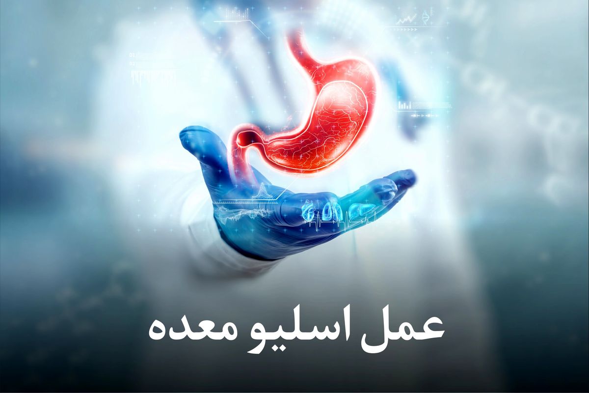 هزینه عمل اسلیو معده با بیمه تکمیلی