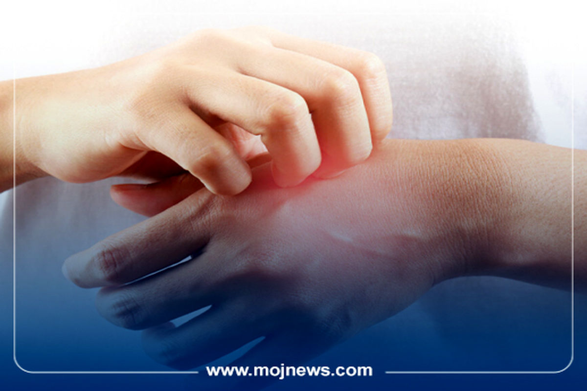 کاور خود ایمنی