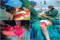 ۶ ساعت تلاش موفقیت آمیز پزشکان برای ترمیم دست قطع شده در بیمارستان فاطمی اردبیل 