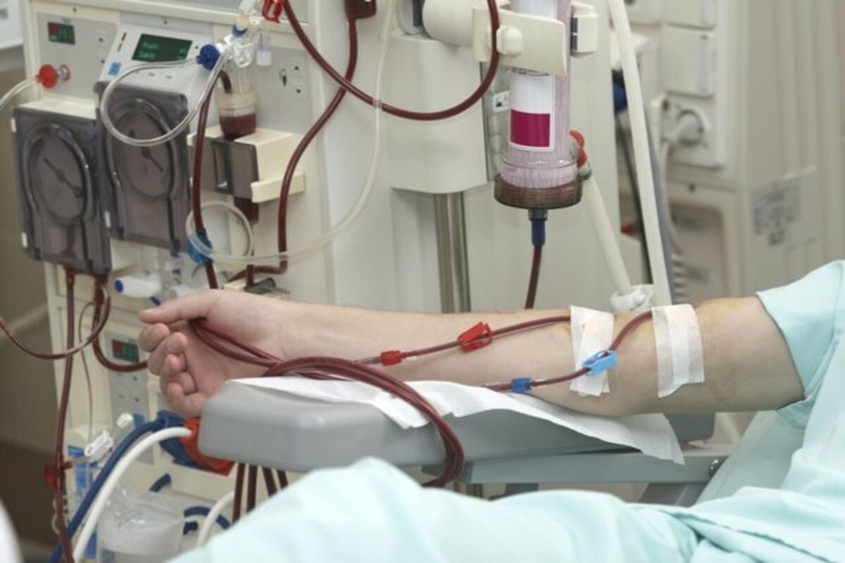 دستگاه دیالیز