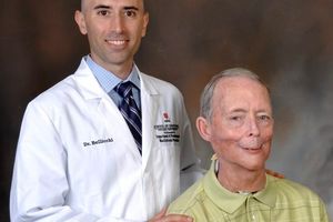 فک سه بعدی روی صورت یک بیمار سرطانی قرار گرفت