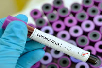 تشریح آخرین وضعیت کرونا در هرمزگان