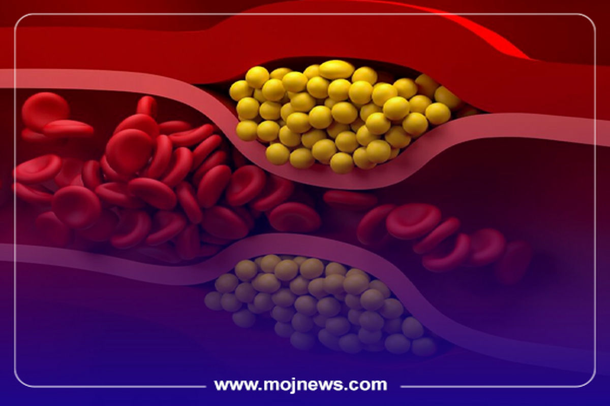 کاور کلسترول موج