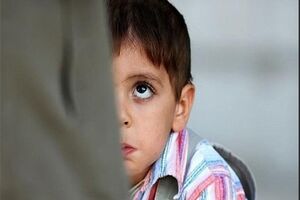 علائم استرس در کودکان / مراقب این نشانه ها در فرزندانتان باشید