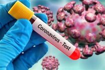 75 ابتلای جدید به ویروس کرونا طی شبانه روز گذشته در کاشان / حداقل سن بستری 10 سال