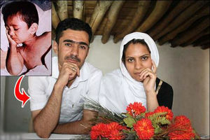 درخواست جوانترین جانباز شیمیایی کشور از رئیس جمهور