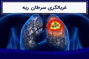 غربالگری سرطان ریه!