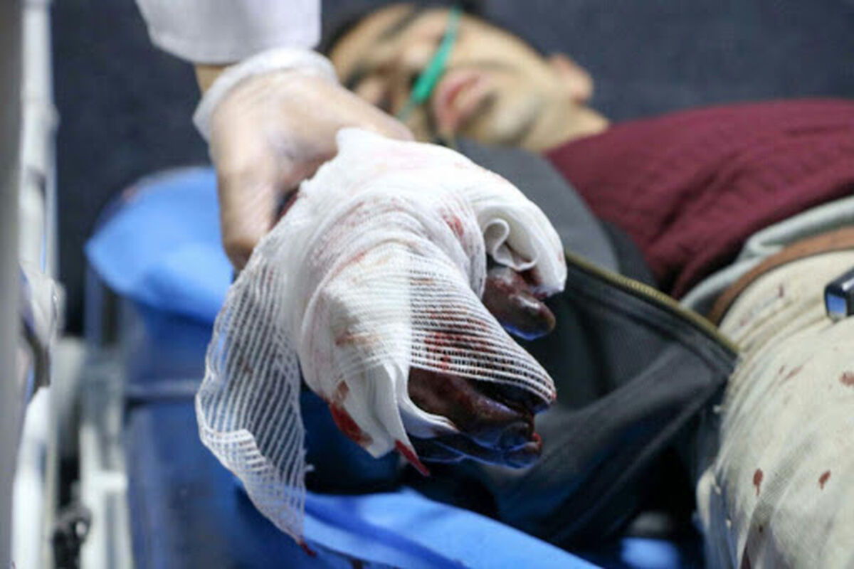 مصدومین چهارشنبه سوری