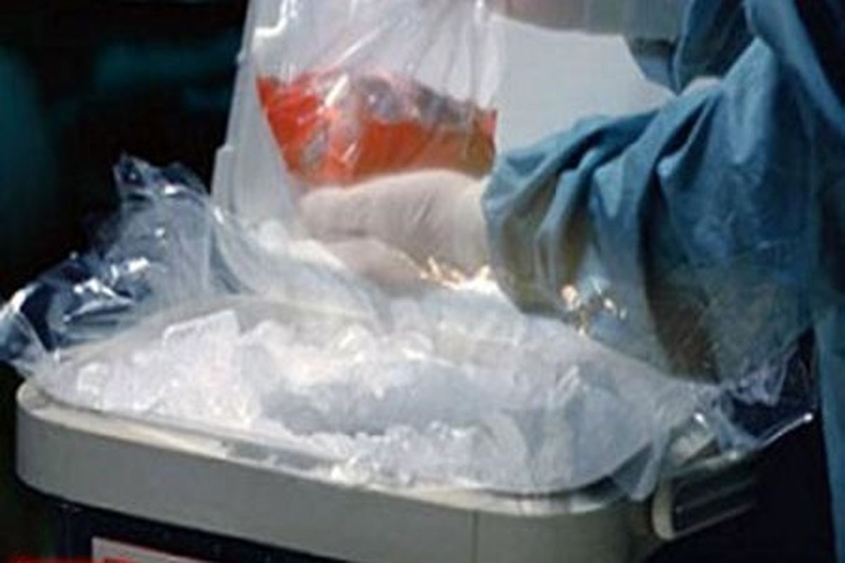 قاچاق اعضای بدن