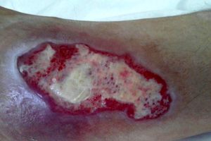 همایش ترمیم زخم فردا برگزار می‌شود