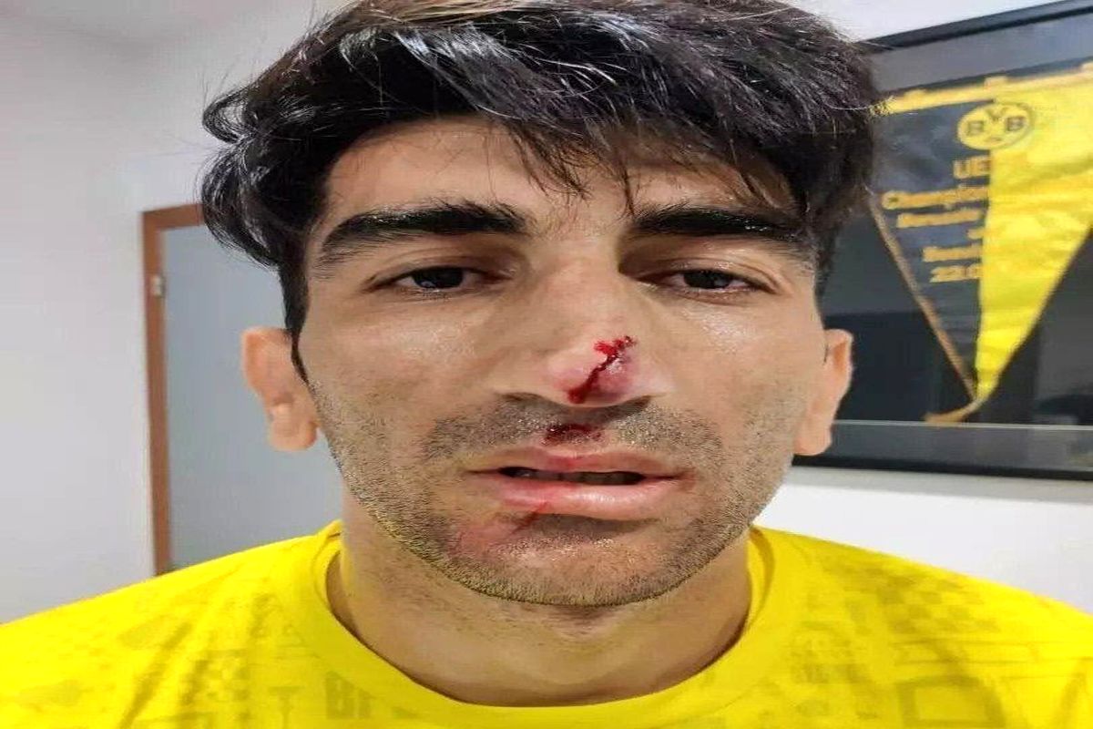 علیرضا بیرانوند