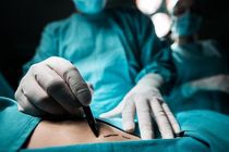 مرگ تلخ زن جوان براثر جراحی لاغری در بیمارستان