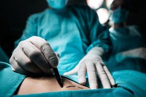 مرگ تلخ زن جوان براثر جراحی لاغری در بیمارستان