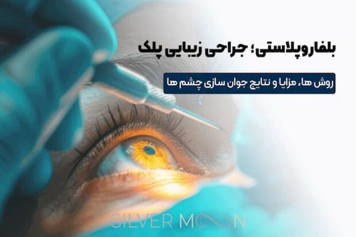 بلفا