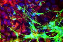 ۱۵ شورای توسعه علوم و فناوری های سلول های بنیادی راه اندازی می شود