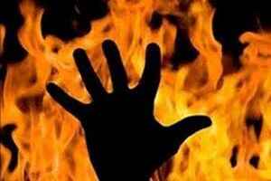 فردی که مقابل شهرداری خودسوزی کرده بود درگذشت