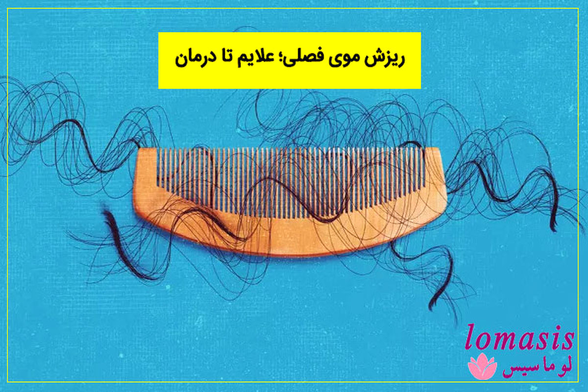 ریزش مو