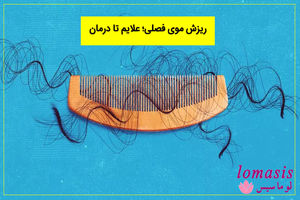 با روش های درمان ریزش مو لوماسیس آشنا شوید!