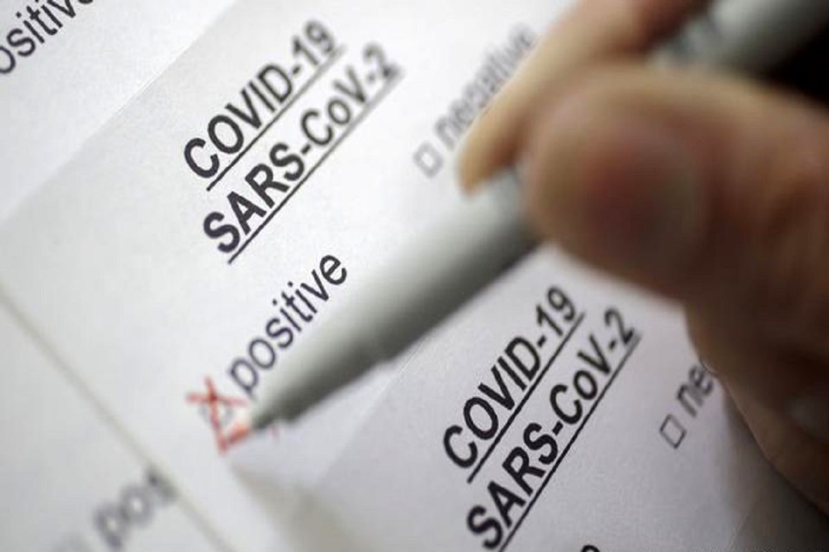 تست p.c.r کرونا