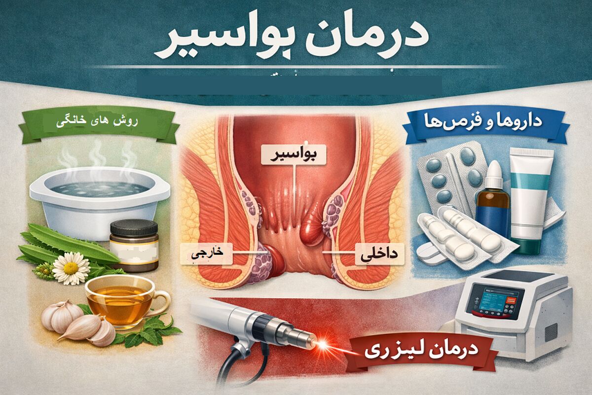 درمان بیرون‌زدگی بواسیر