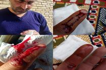 مصدوم شدن کارشناس واحد بهداشت شبکه دامپزشکی شهرستان فلاورجان حین انجام واکسیناسیون هاری
