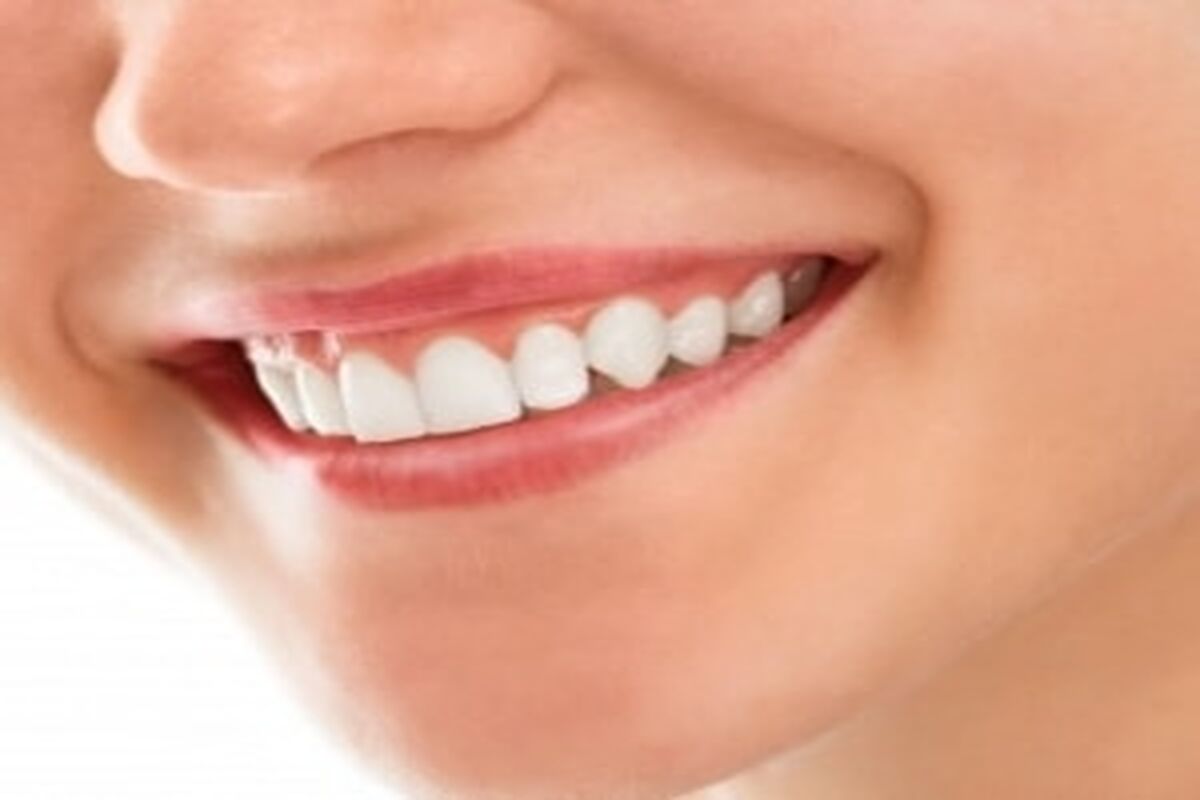 سلامت دهان و لثه