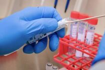 آخرین آمار مبتلایان به کرونا در جهان/  ۳۴۰ هزار و ۴۷ نفر جان خود را از دست داده‌اند