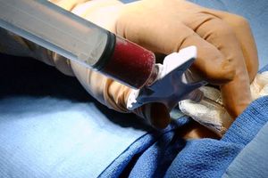 اصفهان مجهز به بخش پیوند آلوژن مغز استخوان شد