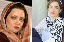 بهنوش طباطبایی با 100 میلیون دگرگون شد / چهار عمل زیبایی که بهنوش طباطبایی را جوان کرد + عکس
