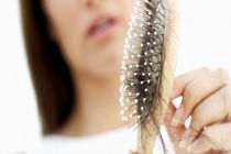 درمان ریزش مو با داروی پوکی استخوان