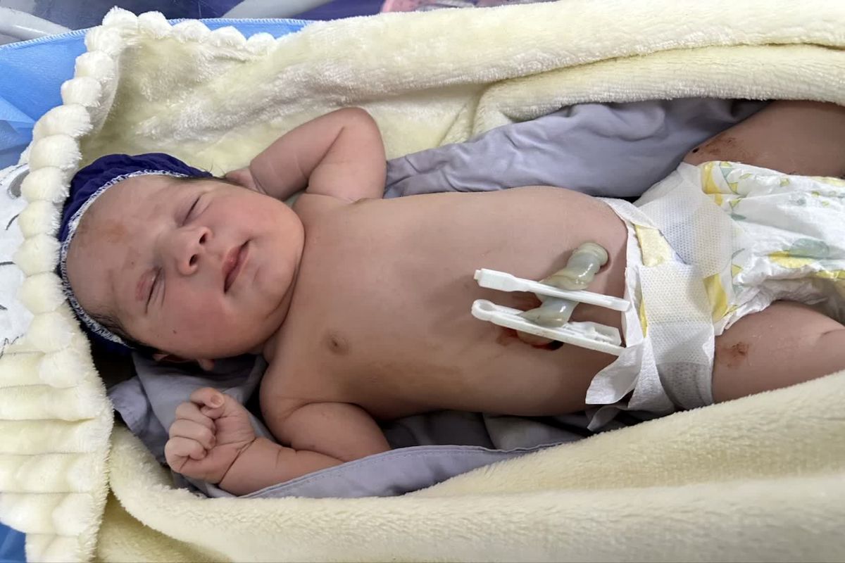 تولد نوزاد 4و نیم کیلویی در اردبیل