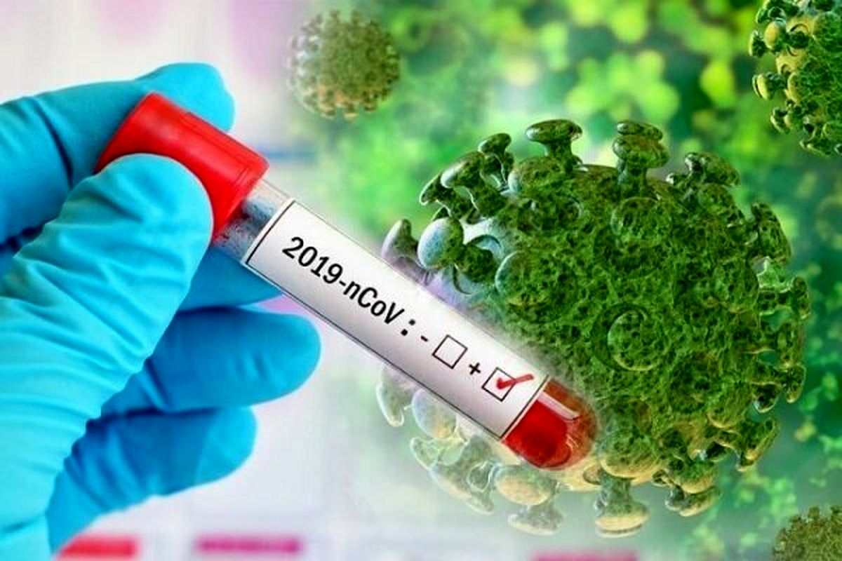 تست کووید