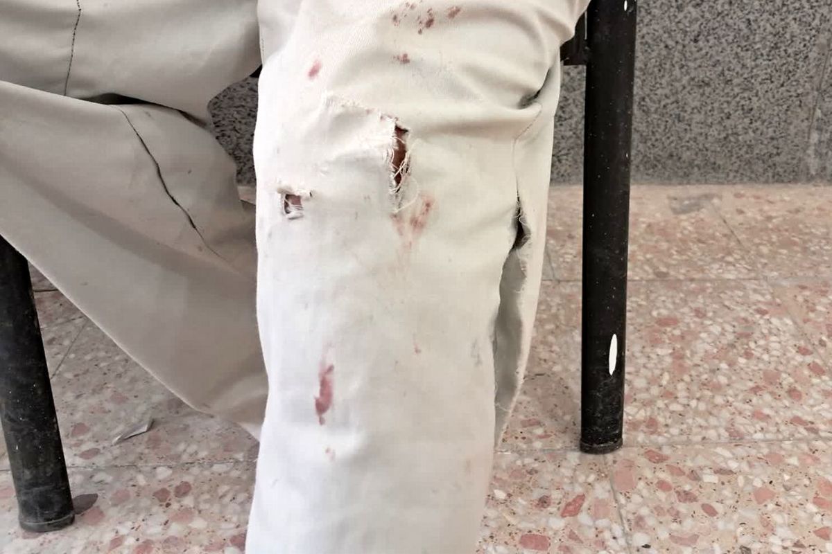 سگ هار