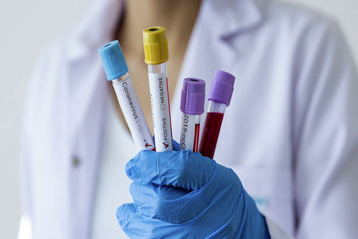 ویروس کرونا