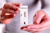ساخت کیت ارزان قیمت تشخیص کرونا