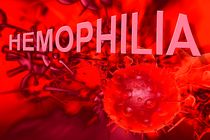 جزئیات ارائه خدمات بیمه سلامت به بیماران هموفیلی
