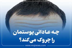 اینفوگرافیک/ چه عاداتی پوستمان را چروک می کند؟