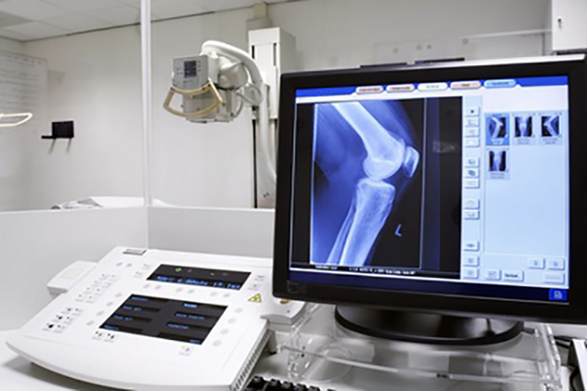 رادیولوژی دیجیتال