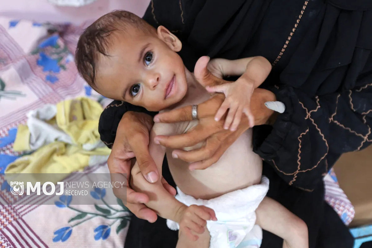 گرسنگی فاجعه بار در غزه