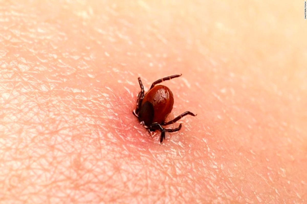 تب کریمه کنگو