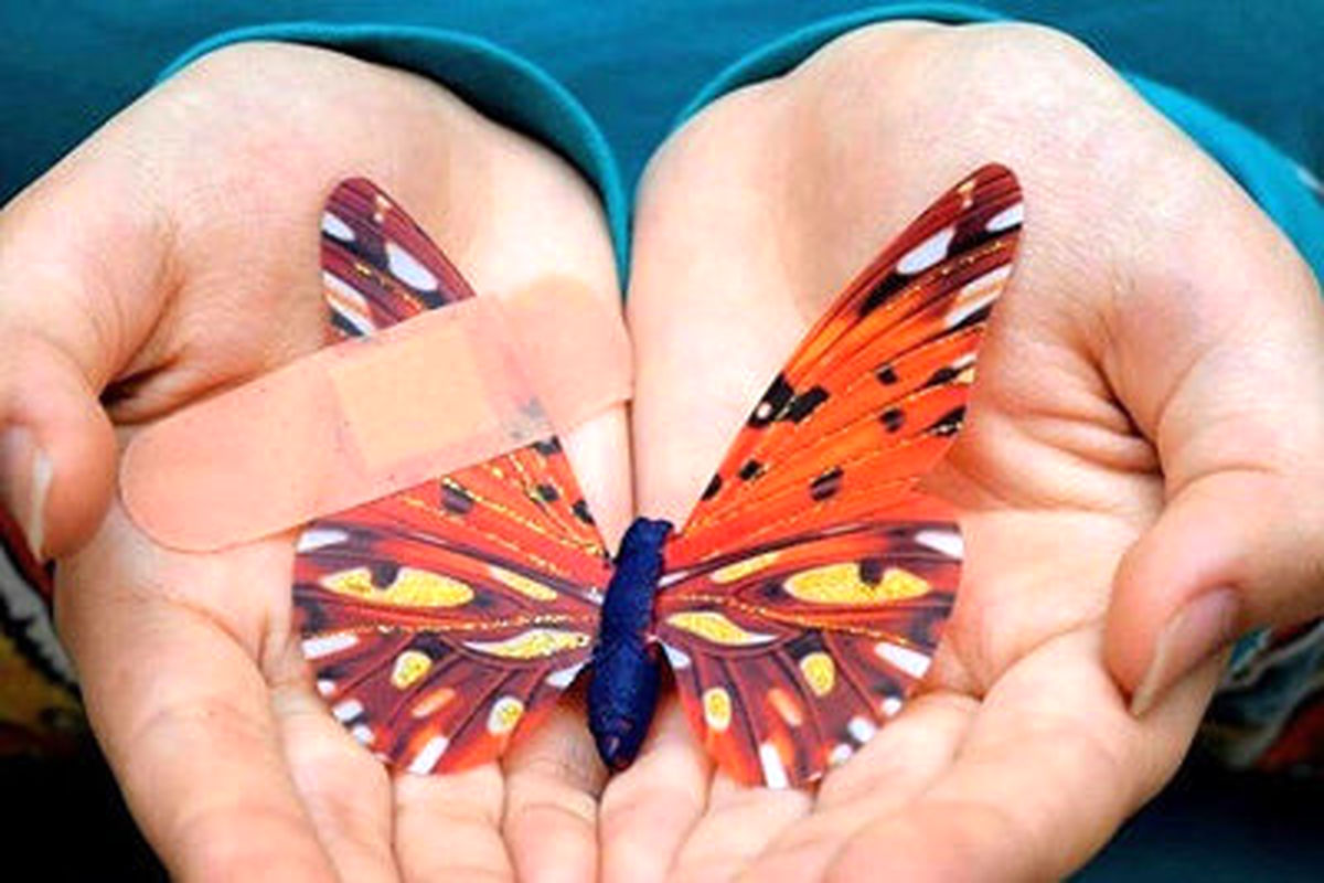 بیماری پروانه ای 