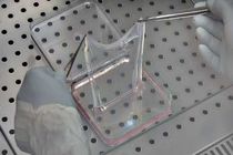 درمان بیماری پروانه‌ای 